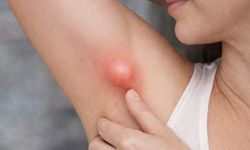 Koltuk Altındaki Şişlik Her Zaman Masum Değil