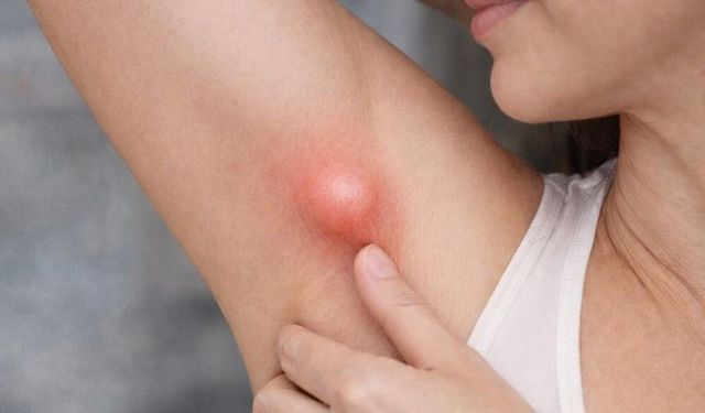 Koltuk Altındaki Şişlik Her Zaman Masum Değil