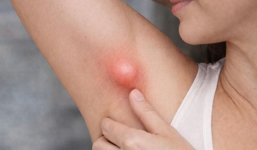 Koltuk Altındaki Şişlik Her Zaman Masum Değil